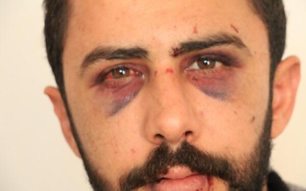 Mersin emniyetinde işkence: Bot ve joplarla vurdular