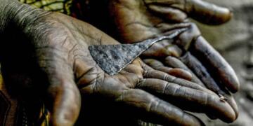 Raperîn ve Hewlêr’de bir yılda 110 kız çocuğu sünnet edildi