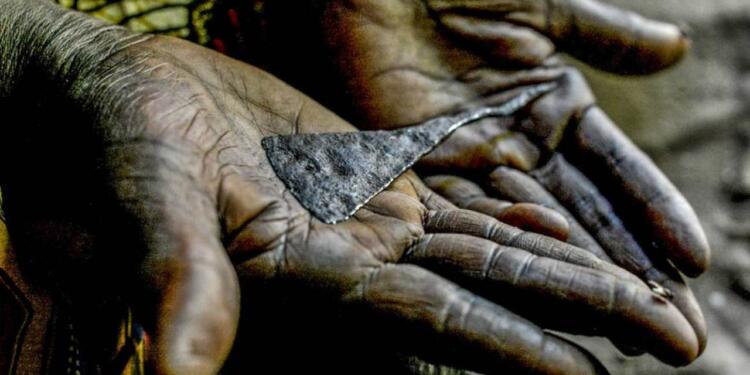 Raperîn ve Hewlêr’de bir yılda 110 kız çocuğu sünnet edildi