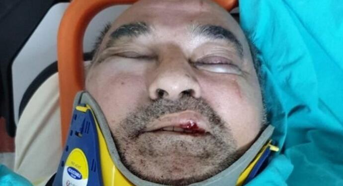 Yolsuzlukları dile getirmişti: Gazeteci Ergün saldırıya uğradı