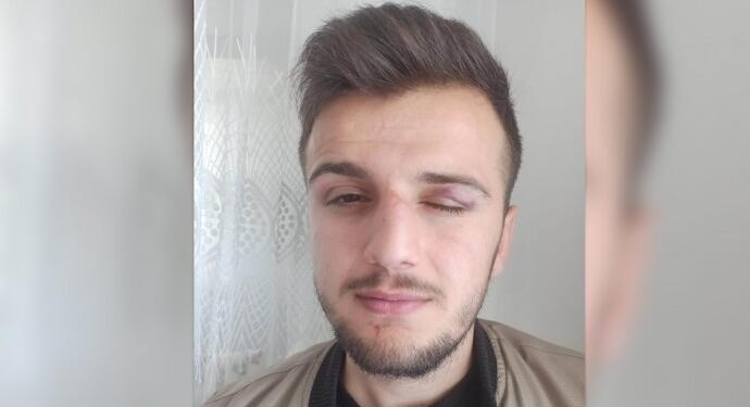 Şiddet uyguladılar, ‘Neden ülkücü işareti yapmıyorsun’ dediler