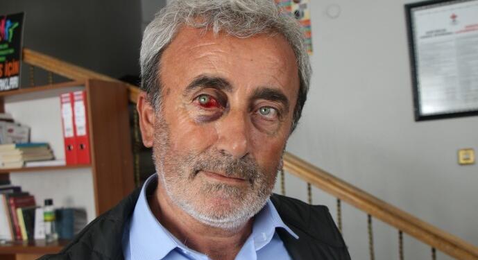 Gözaltında başına çuval geçirildi, işkence gördü: Doktor darp raporu vermedi