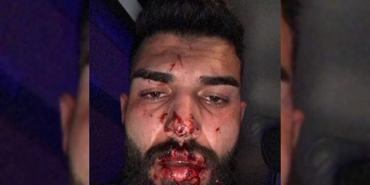 Dersim’de uzman çavuşlar kavga etti: Polis çevredekilere işkence yaptı