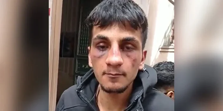Şiddet uygulamaları yetmedi, “polise mukavemetten’ suçlandılar