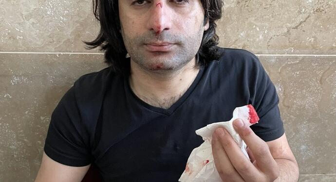 Polis işkenceye karşı çıkan avukatı adliyede darp etti