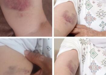 Polisin işkencesine maruz kaldılar: Tutuklu yakınları suç duyurusunda bulundu