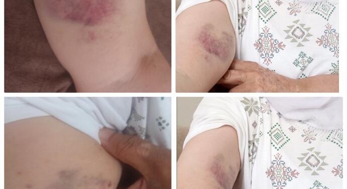 Polisin işkencesine maruz kaldılar: Tutuklu yakınları suç duyurusunda bulundu