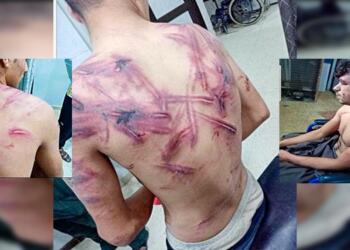 ‘Kürt müsünüz!’ deyip işkence yaptılar