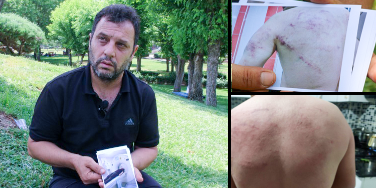 Kalıp işçisi, AKP’li işverenin başına silah dayadığını ve darp edildiğini iddia etti