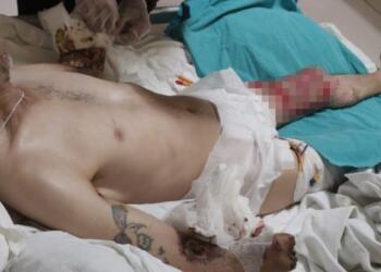 İki kolu kesilen tutukluya verilen rapor dikkate alınmadı!