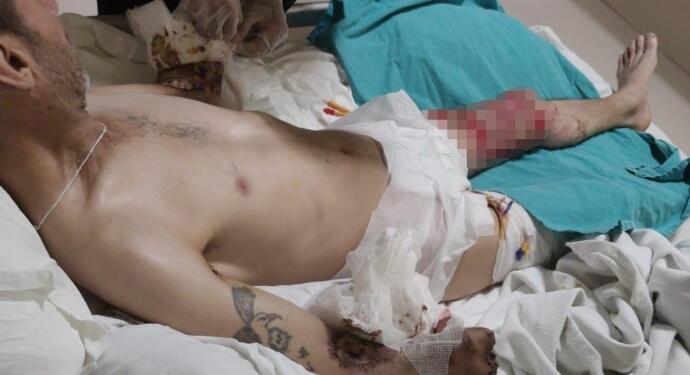 İki kolu kesilen tutukluya verilen rapor dikkate alınmadı!