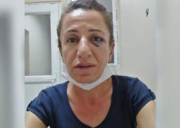 Köpekle işkence basit yaralamaymış!