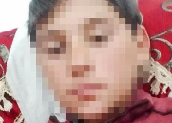 Askeri cismin patlaması sonucu koyun otlatan çocuğun bileği koptu