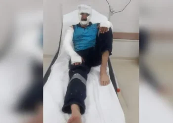 Rögar kapağında patlama: 2 işçi yaralandı