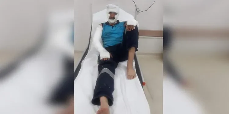 Rögar kapağında patlama: 2 işçi yaralandı