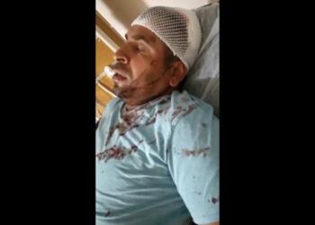 Sakarya’da ırkçı saldırı: Mevsimlik işçi darp edildi