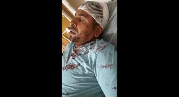 Sakarya’da ırkçı saldırı: Mevsimlik işçi darp edildi