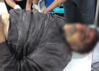 Til Temir, Zirgan ve Til Rifat bombalandı: Yine çocuklar vuruldu