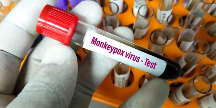 Sağlık Bakanı: Türkiye’de 5 maymun çiçeği vakası tespit edildi