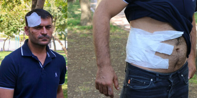 Irkçı saldırıya uğrayan Oran: Kürtçe konuştuğumuz için hedef olduk