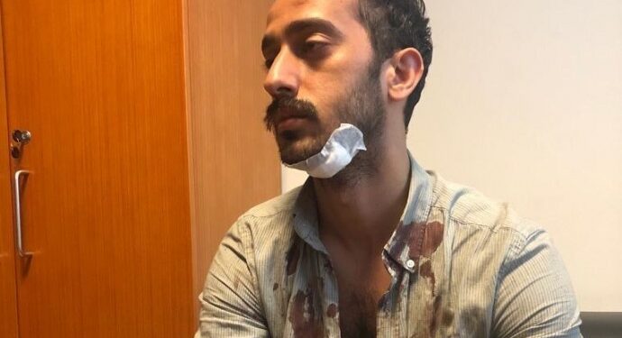 İşkence yapan polisler hakkında soruşturma başlatıldı