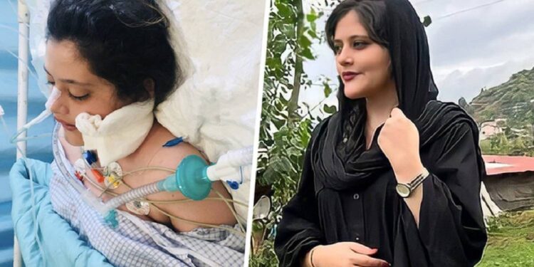 Amini kafasına aldığı darpla katledilmiş