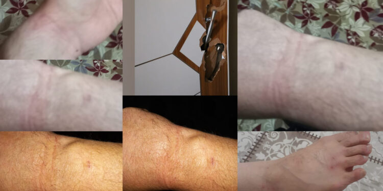 Yüksekova’da bir aileye işkence: Oğlum artık konuşamıyor