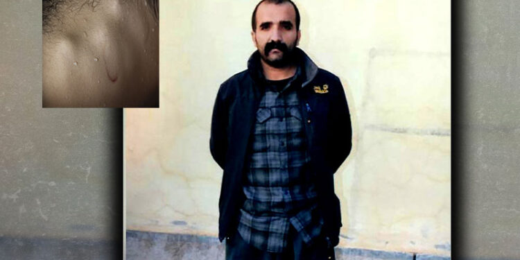 Cezaevinde yaşamını yitiren Çabuk’un vücudunda darp izleri