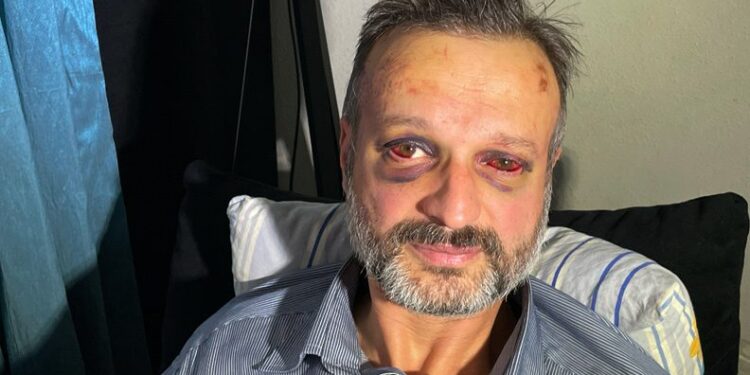 Müzisyenin kaburgasını kıranlar serbest!