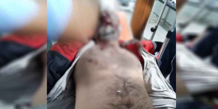 Türkiye’nin hava saldırıları: 3 Şam askeri öldü, PYD ‘savunma’ çağrısı yaptı