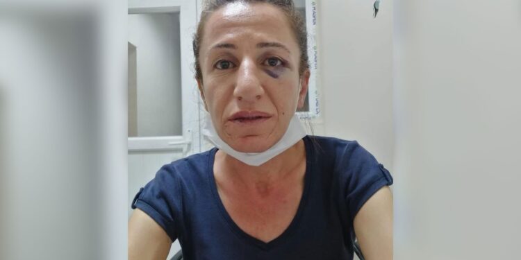 Köpekli işkenceye uğrayan Çetin’e üst sınırdan ceza istemi