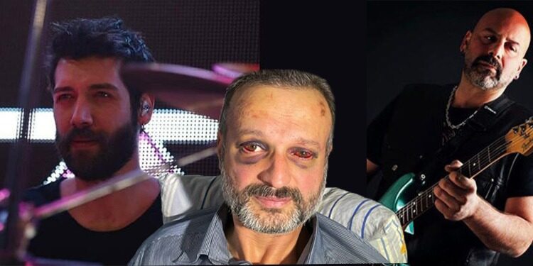 Müzisyenlere şiddet bitmiyor: Dudarık’ın hayati tehlikesi sürüyor