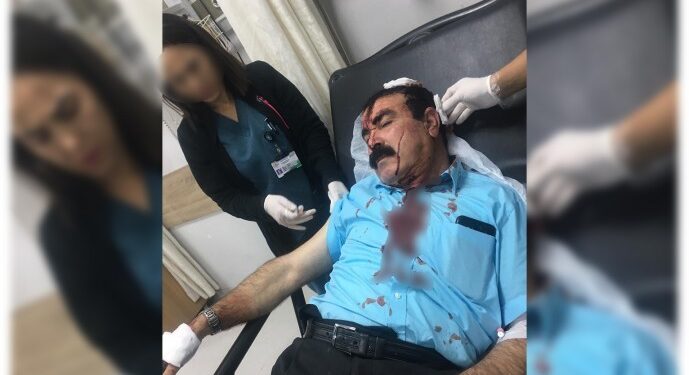 ‘Saldırı faili firari korucular görev başında’