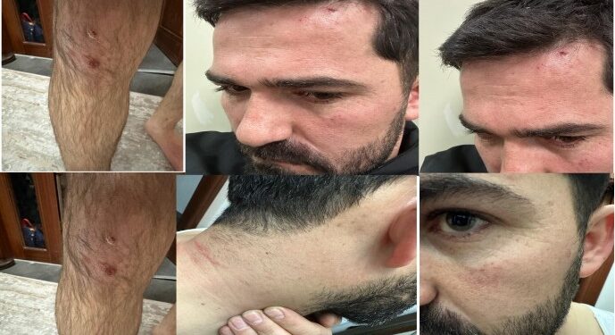 Cenaze dönüşü polis işkencesi: Kafamı yere sürttüler