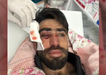 Polis gönüllüleri kaçırıp işkence yaptı!