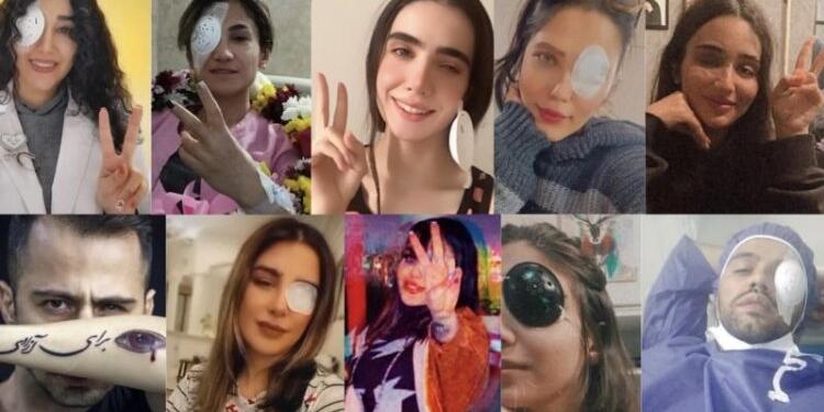 İran’da protestolarda 22 kişi gözünü kaybetti