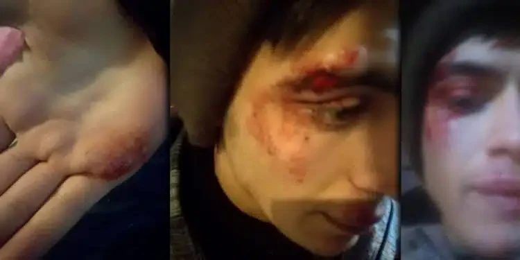 Partizan okuruna sokak ortasında işkence