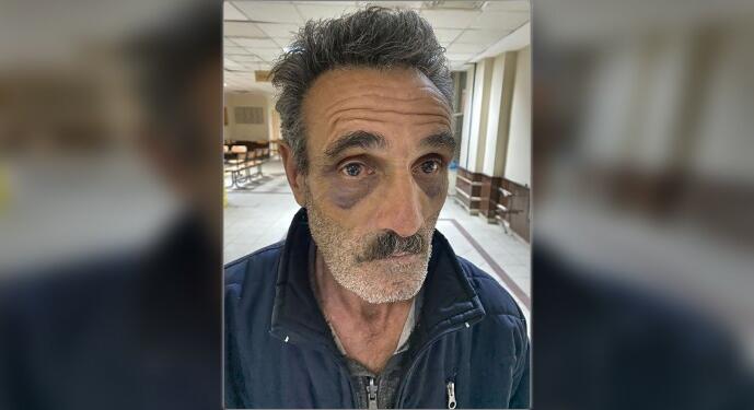 Polis merkezinde işkence: Çırılçıplak soyuldum, elektirikle tehdit edildim