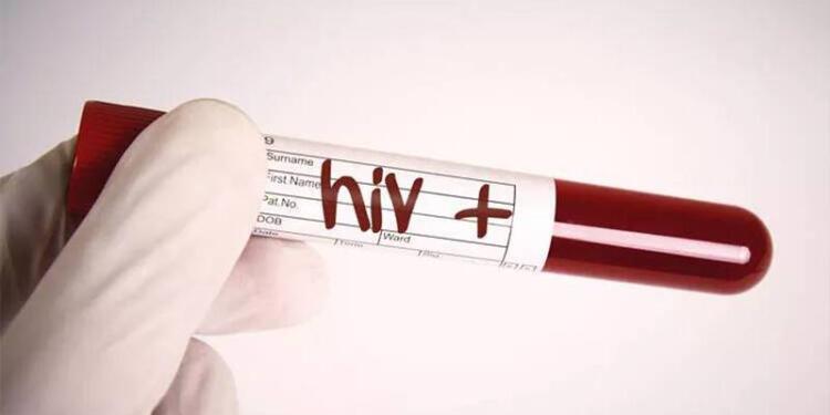 İlk vukuat değil: Kızılay yine HIV’li kan verdi