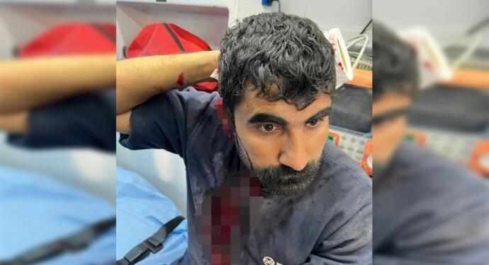 Amed Barosu’ndan ırkçı saldırıya ilişkin açıklama: Nefret suçu cezasız kalmasın