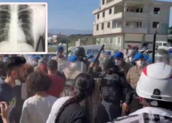 Jandarma saldırısında depremzedenin iki kaburgası kırıldı