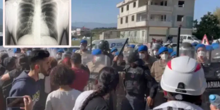 Jandarma saldırısında depremzedenin iki kaburgası kırıldı