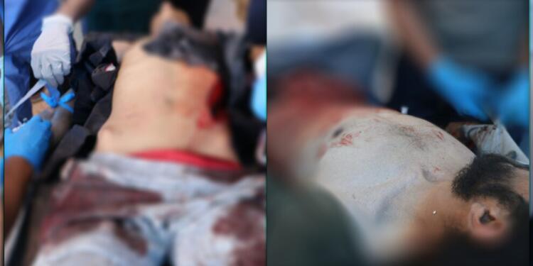 Türkiye Eyn Îsa’da sivilleri hedef aldı