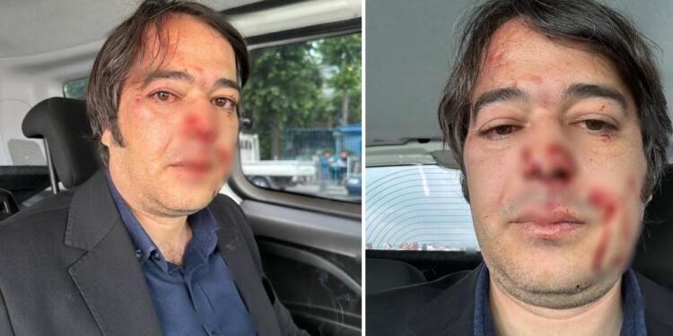 Kaçak kafe yıkımı esnasında İBB İmar Müdürü darbedildi