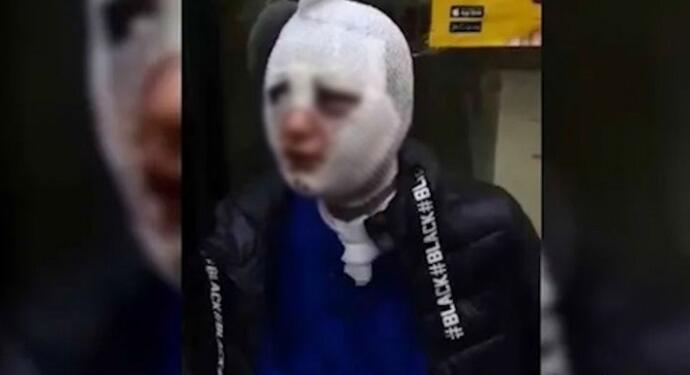 Kadını katletme girişimine ödül gibi ceza