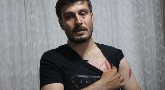 Bismil’de polis şiddeti MOBESE’ye yansıdı