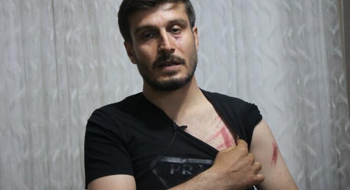 Polis yurttaşa saldırdı sonra ‘sinirliydim, kusura bakma’ dedi