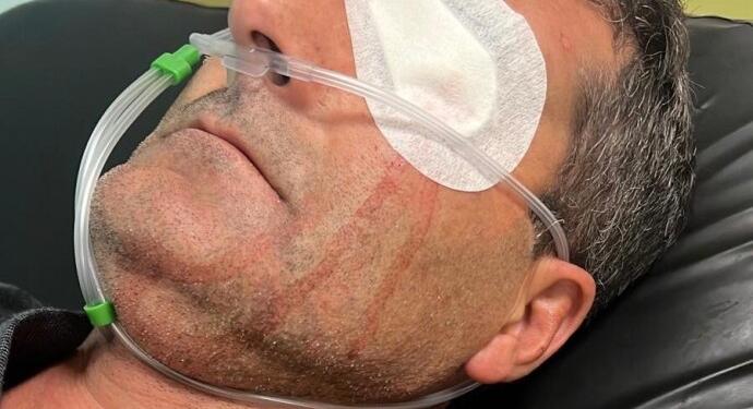 Seçim sonrası AKP’li şiddeti: Saldırıya uğrayan yurttaş ağır yaralandı