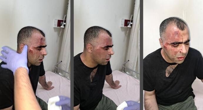 AKP’liye belediye başkanının korumaları gazeteci Aygül’e saldırdı