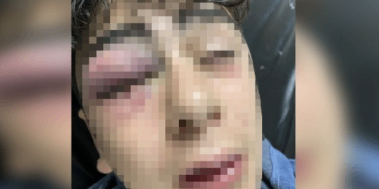 HDP: Yargı yeni işkencecilerin önünü açmaktadır